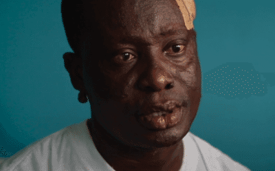 Jean-Marc : La vie plus forte que la lèpre