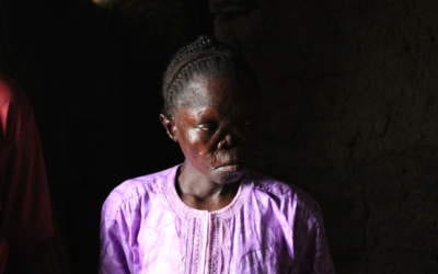 [TRIBUNE] Dr Cauchoix : « Le combat contre la lèpre n’est pas terminé ! »