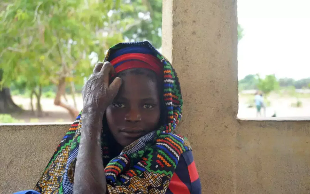 Gisèle, une vie déchirée par la lèpre