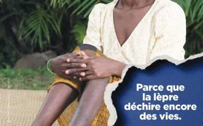 Journée mondiale des malades de la lèpre 2024